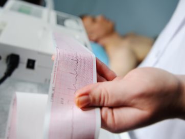 Curso Electrocardiografía avanzada
