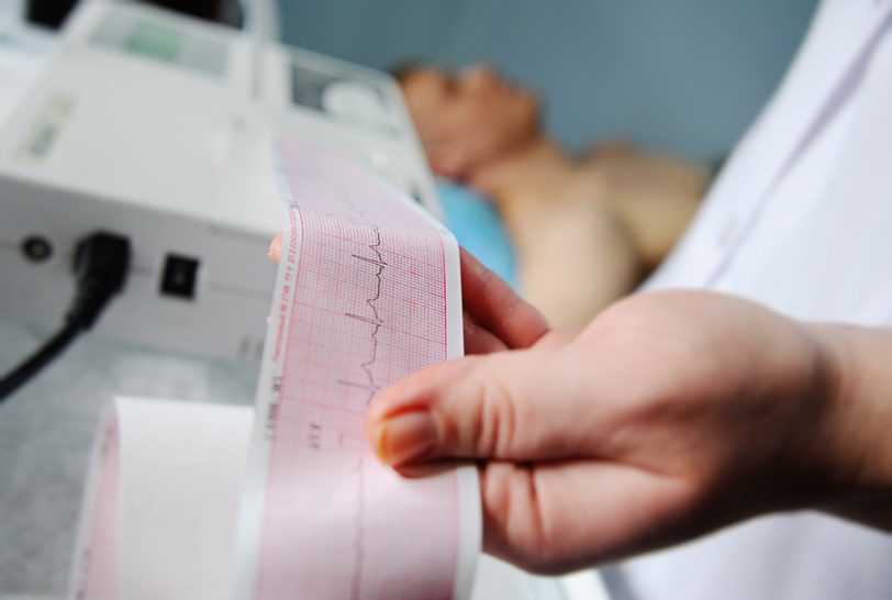 Curso Electrocardiografía avanzada