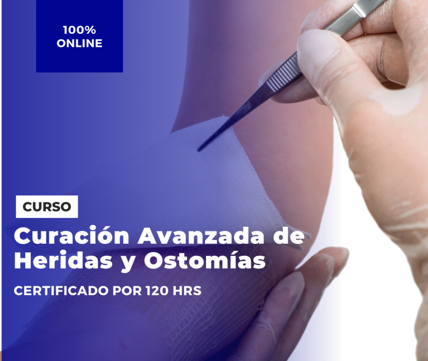 Curación Avanzada de Heridas y Ostomías