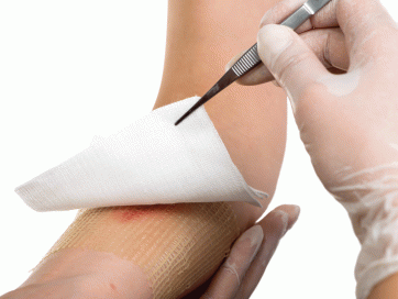 Curso Curación Avanzada de Heridas y Ostomías