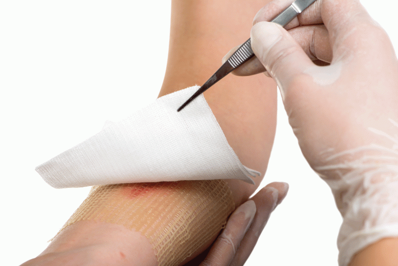 Curso Curación Avanzada de Heridas y Ostomías