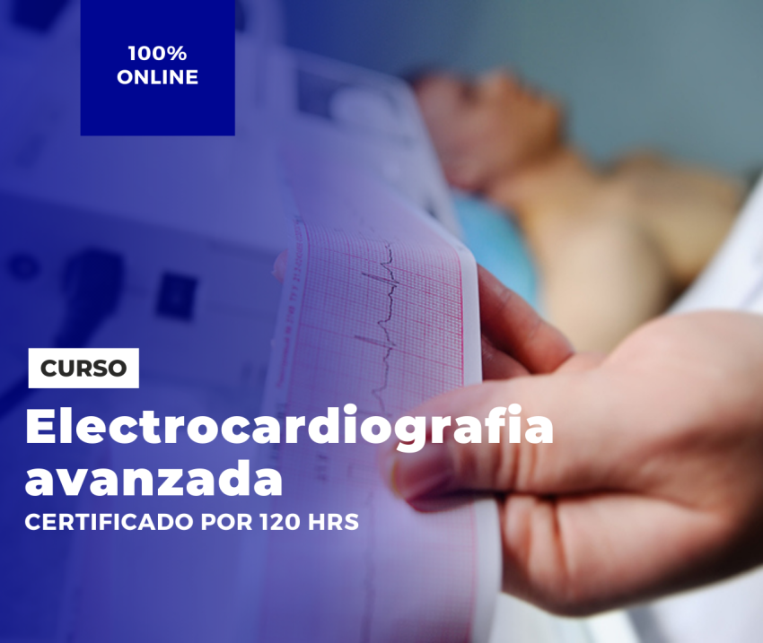 Electrocardiografía avanzada