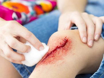 Cuidado básico de Heridas 21 hrs