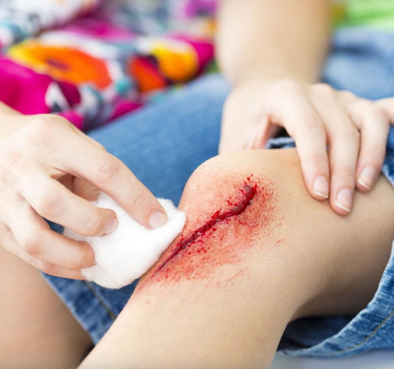 Cuidado básico de Heridas 21 hrs
