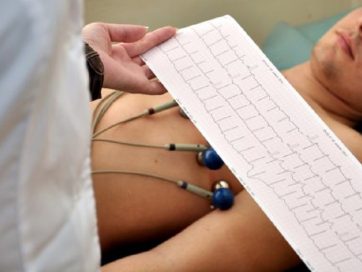 Electrocardiografía básica