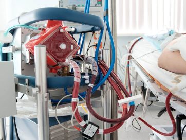 ECMO PEDIÁTRICO Y NEONATAL