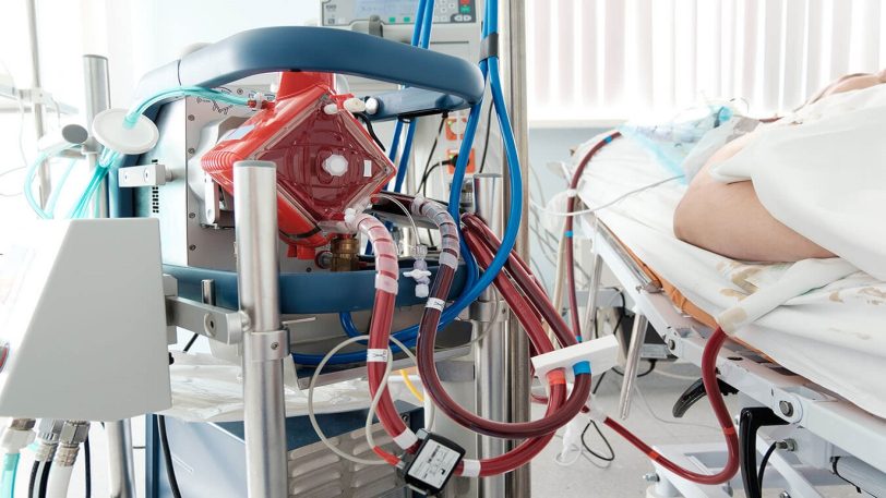ECMO PEDIÁTRICO Y NEONATAL
