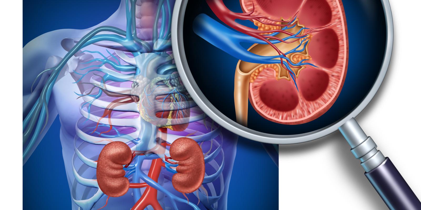 Enfermedad renal